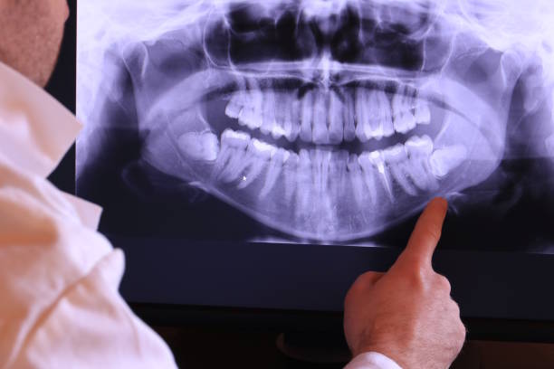Best Emergency Denture Repair in New Philadelphia, OH
